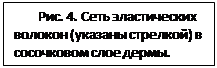 Підпис: Рис. 4. Сеть эластических волокон (указа¬ны стрелкой) в сосочковом слое дермы.